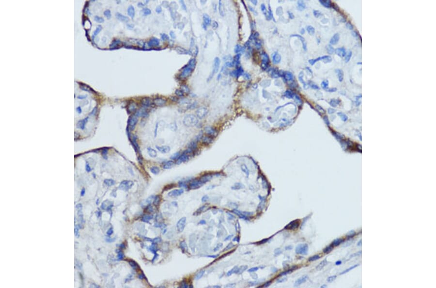 Immunohistochemistry - Anti-Aromatase Antibody (A90105) - Antibodies.com