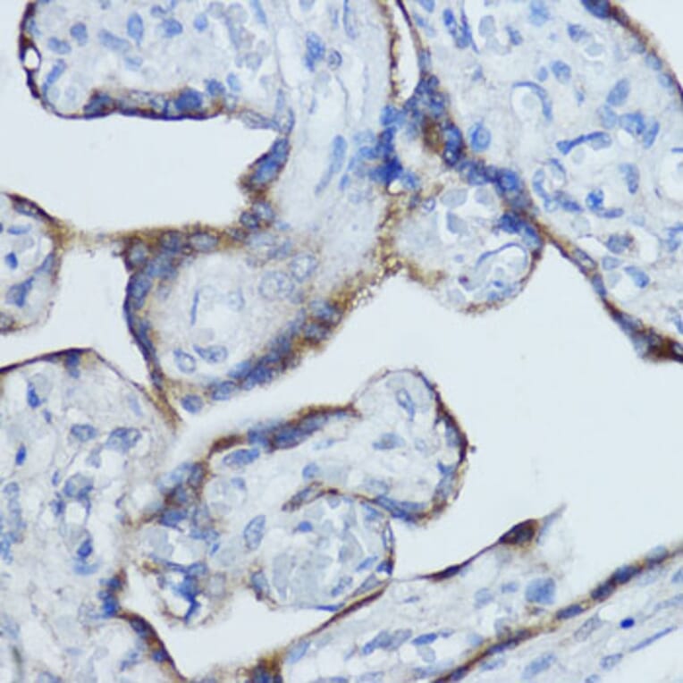 Immunohistochemistry - Anti-Aromatase Antibody (A90105) - Antibodies.com