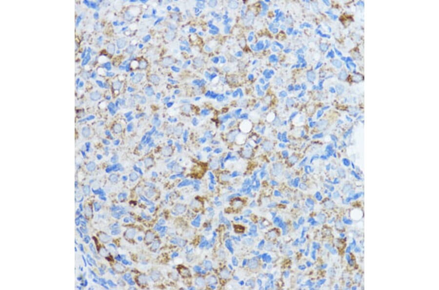 Immunohistochemistry - Anti-Aromatase Antibody (A90105) - Antibodies.com