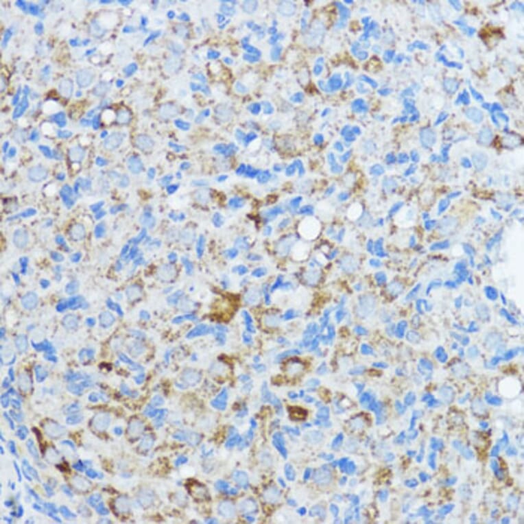 Immunohistochemistry - Anti-Aromatase Antibody (A90105) - Antibodies.com