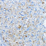 Immunohistochemistry - Anti-Aromatase Antibody (A90105) - Antibodies.com