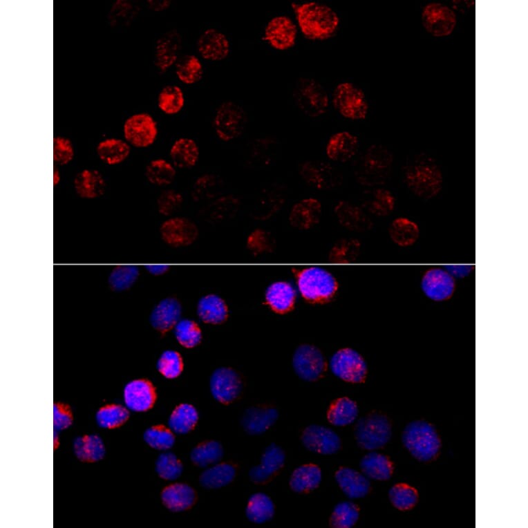 Immunofluorescence - Anti-Aromatase Antibody (A90105) - Antibodies.com