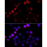 Immunofluorescence - Anti-Aromatase Antibody (A90105) - Antibodies.com