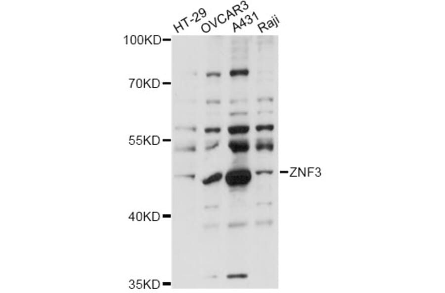 Western Blot - Anti-ZNF3 Antibody (A14382) - Antibodies.com