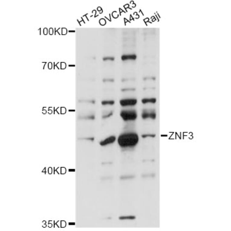 Western Blot - Anti-ZNF3 Antibody (A14382) - Antibodies.com