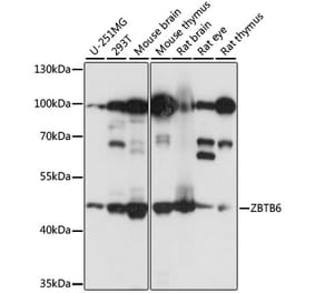 Western Blot - Anti-ZBTB6 Antibody (A90107) - Antibodies.com