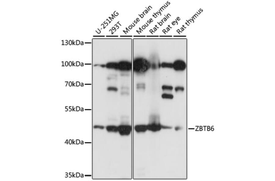 Western Blot - Anti-ZBTB6 Antibody (A90107) - Antibodies.com