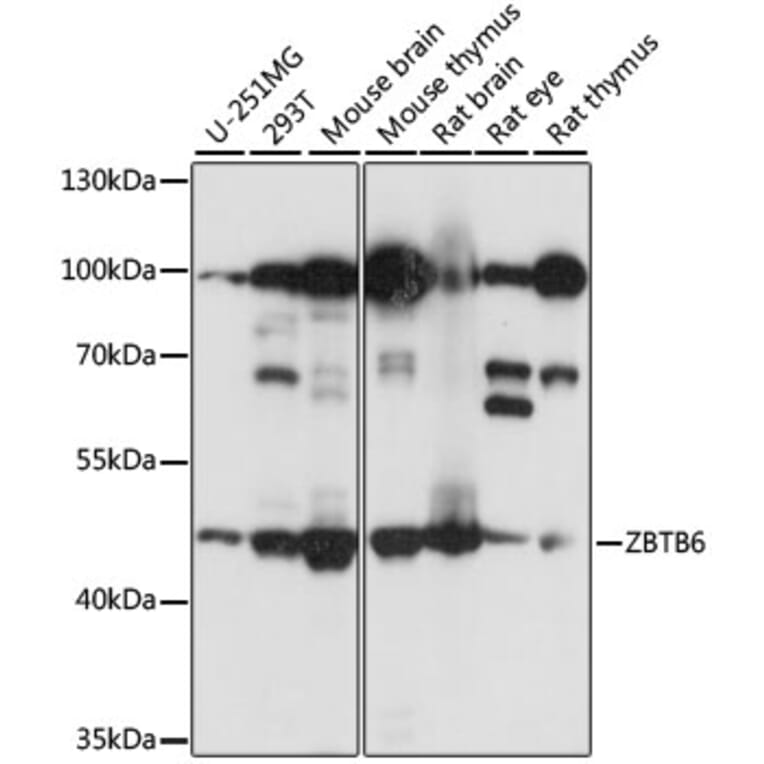 Western Blot - Anti-ZBTB6 Antibody (A90107) - Antibodies.com
