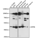 Western Blot - Anti-ZBTB6 Antibody (A90107) - Antibodies.com