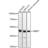 Western Blot - Anti-RBBP7 Antibody (A90109) - Antibodies.com