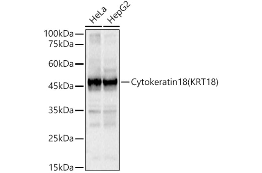 Western Blot - Anti-Cytokeratin 18 Antibody (A90111) - Antibodies.com