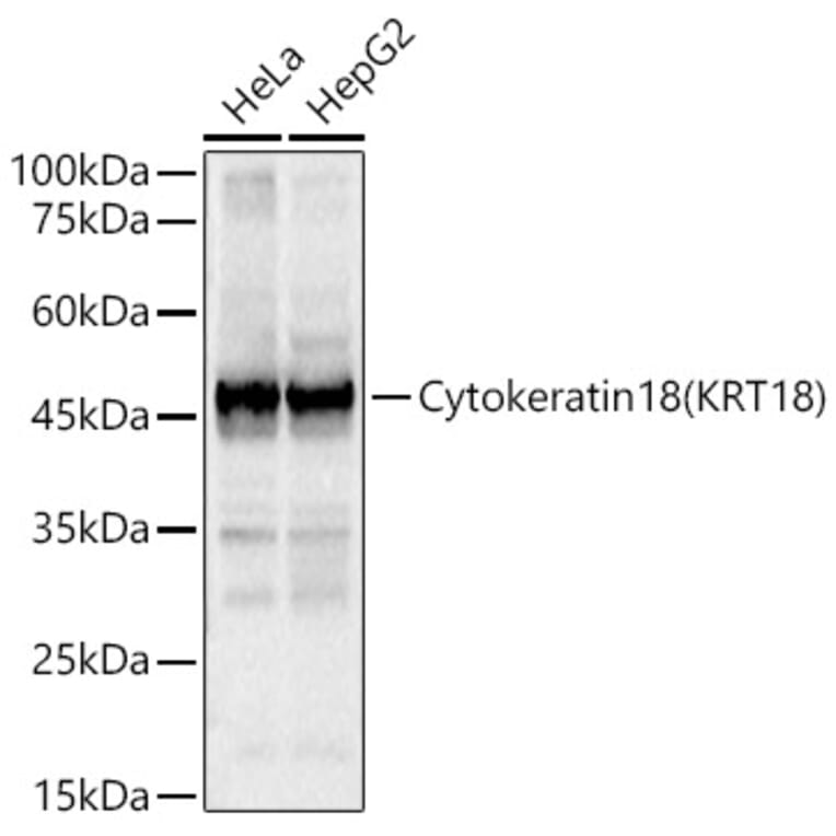 Western Blot - Anti-Cytokeratin 18 Antibody (A90111) - Antibodies.com