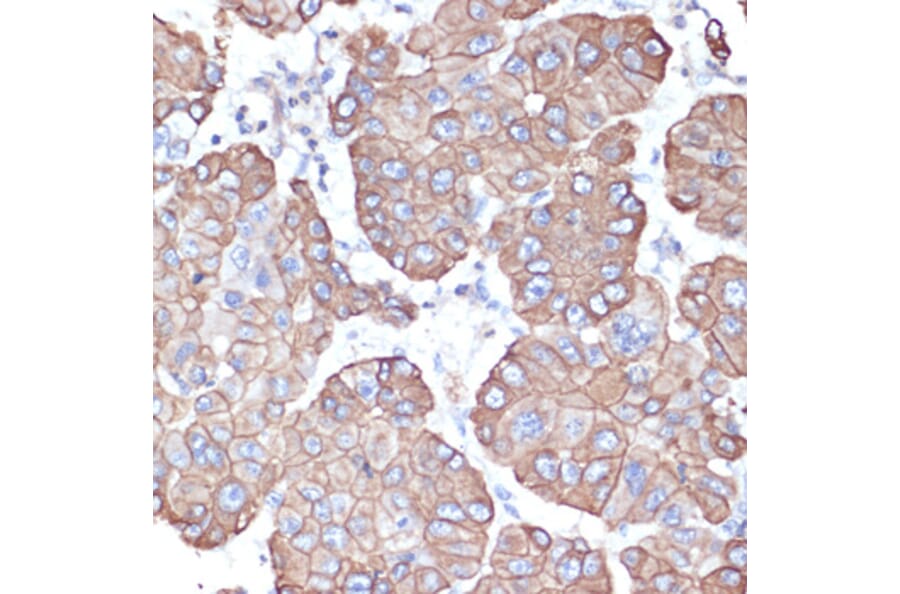 Immunohistochemistry - Anti-Cytokeratin 18 Antibody (A90111) - Antibodies.com