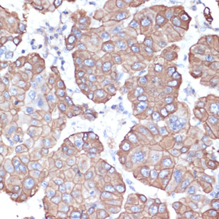 Immunohistochemistry - Anti-Cytokeratin 18 Antibody (A90111) - Antibodies.com