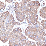Immunohistochemistry - Anti-Cytokeratin 18 Antibody (A90111) - Antibodies.com