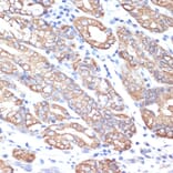 Immunohistochemistry - Anti-Cytokeratin 18 Antibody (A90111) - Antibodies.com
