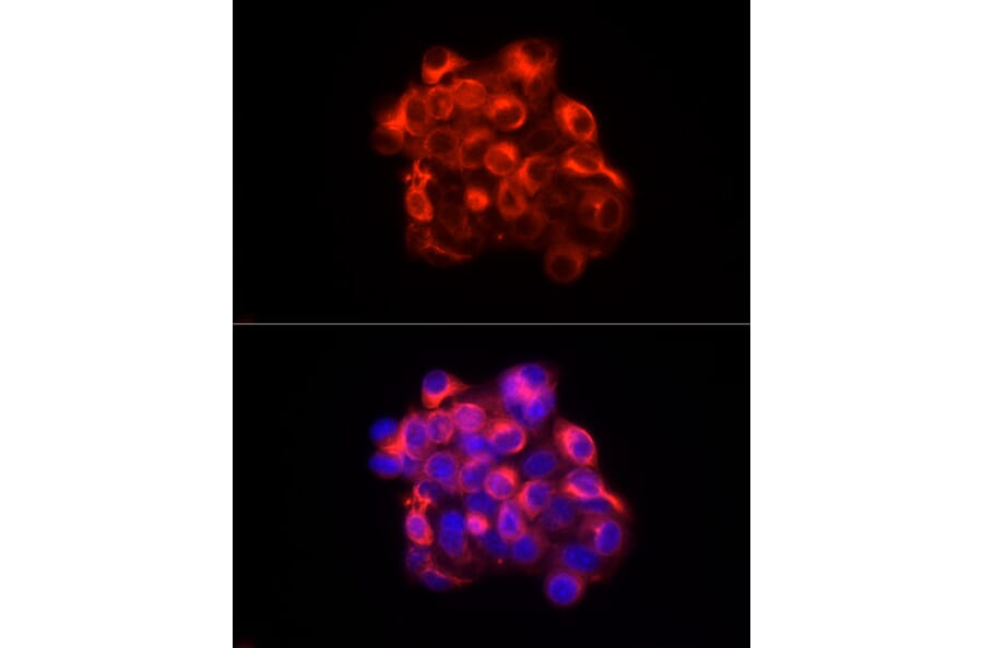 Immunofluorescence - Anti-Cytokeratin 18 Antibody (A90111) - Antibodies.com