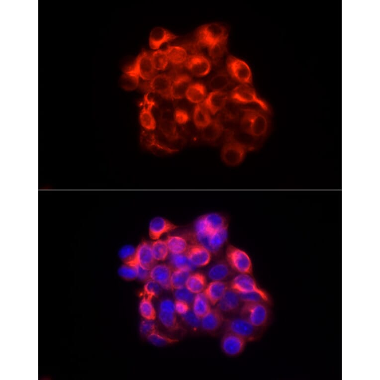 Immunofluorescence - Anti-Cytokeratin 18 Antibody (A90111) - Antibodies.com