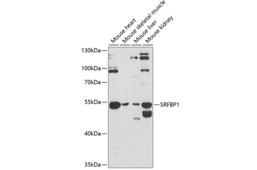 Western Blot - Anti-SRFBP1 Antibody (A90112) - Antibodies.com