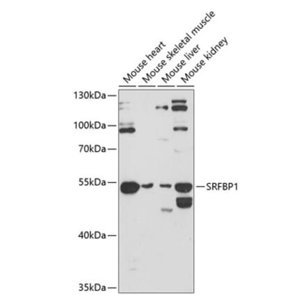 Western Blot - Anti-SRFBP1 Antibody (A90112) - Antibodies.com