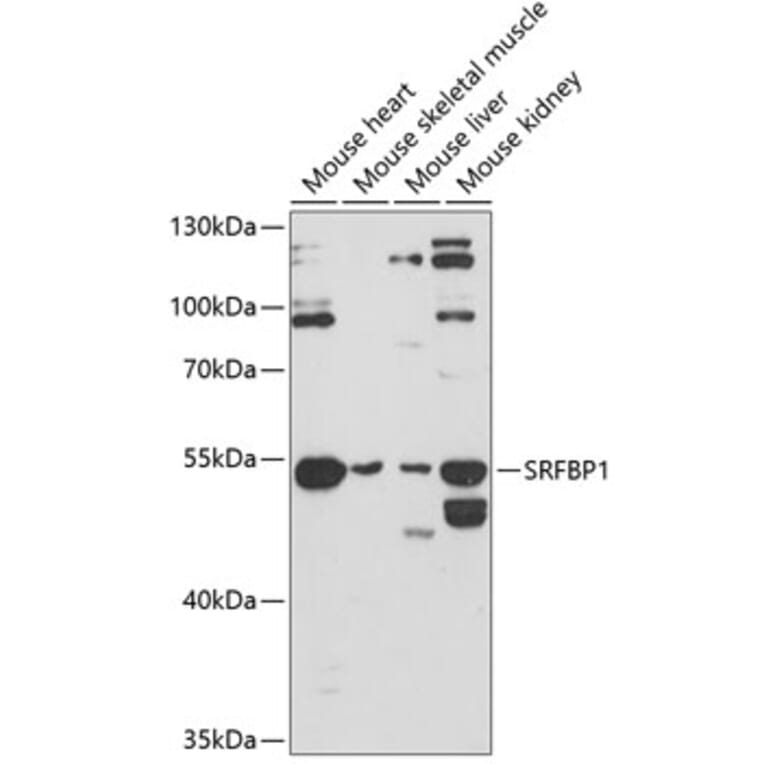 Western Blot - Anti-SRFBP1 Antibody (A90112) - Antibodies.com