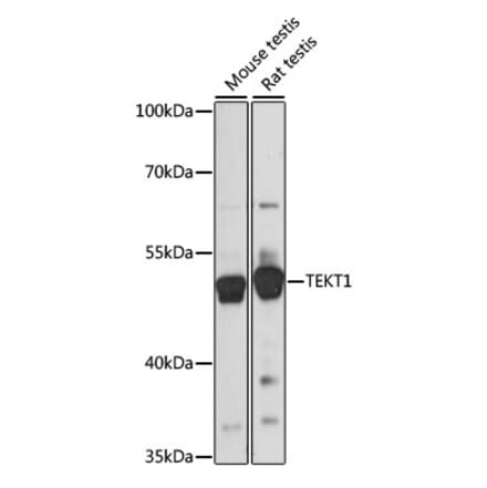 Western Blot - Anti-TEKT1 Antibody (A90113) - Antibodies.com