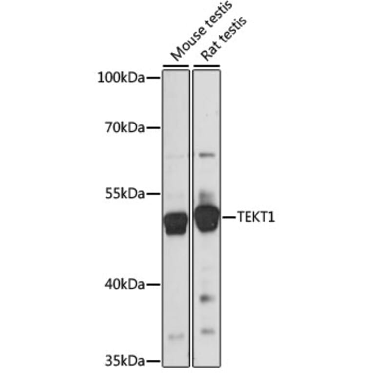 Western Blot - Anti-TEKT1 Antibody (A90113) - Antibodies.com