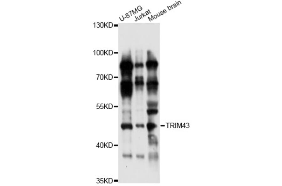 Western Blot - Anti-TRIM43 Antibody (A14444) - Antibodies.com