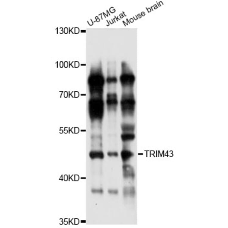 Western Blot - Anti-TRIM43 Antibody (A14444) - Antibodies.com