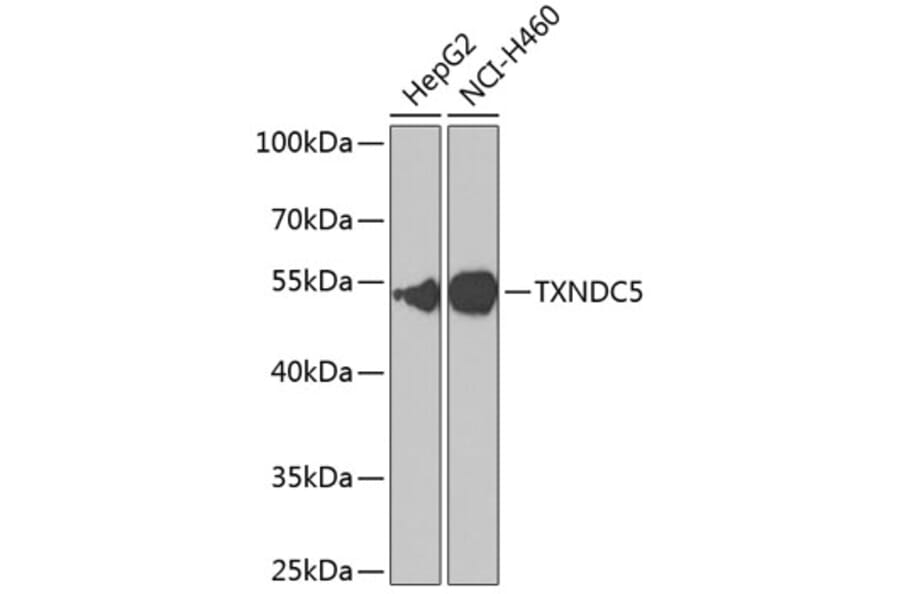 Western Blot - Anti-TXNDC5 Antibody (A90115) - Antibodies.com