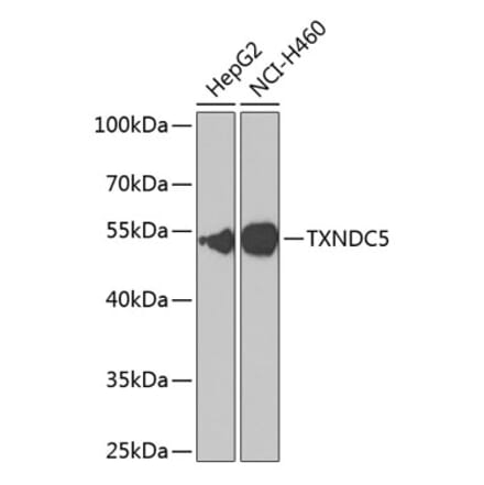 Western Blot - Anti-TXNDC5 Antibody (A90115) - Antibodies.com