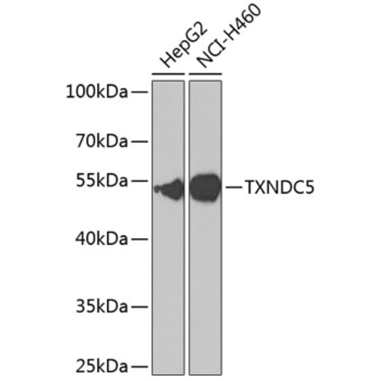 Western Blot - Anti-TXNDC5 Antibody (A90115) - Antibodies.com