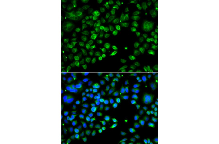 Immunofluorescence - Anti-TXNDC5 Antibody (A90115) - Antibodies.com
