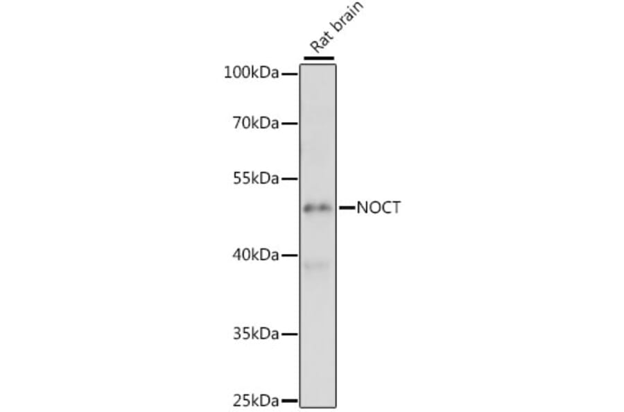 Western Blot - Anti-Nocturnin Antibody (A90116) - Antibodies.com