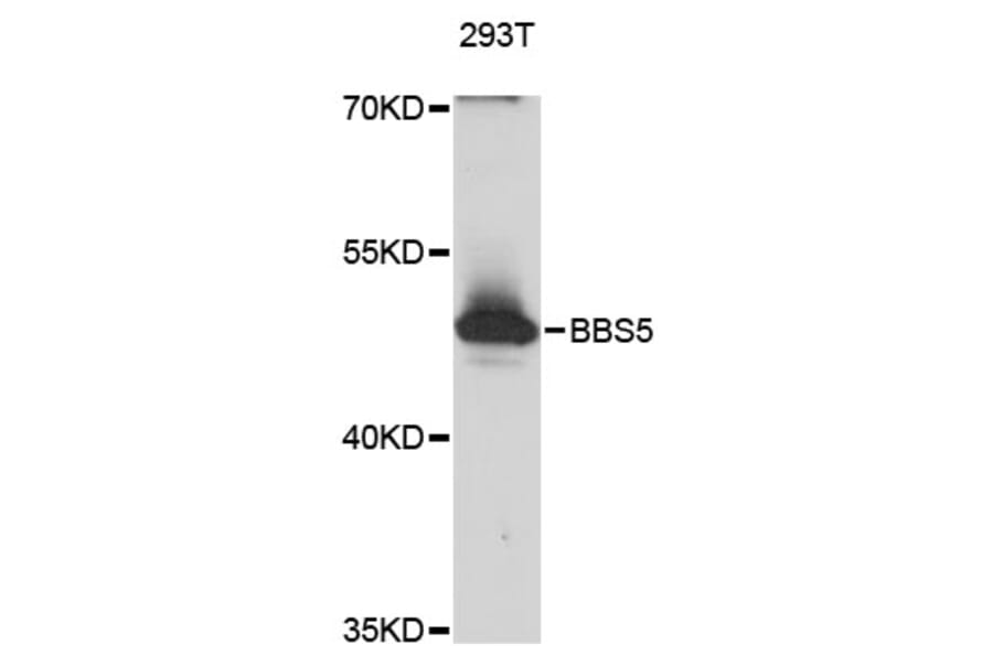 Western Blot - Anti-BBS5 Antibody (A12681) - Antibodies.com