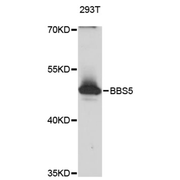 Western Blot - Anti-BBS5 Antibody (A12681) - Antibodies.com