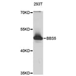 Western Blot - Anti-BBS5 Antibody (A12681) - Antibodies.com