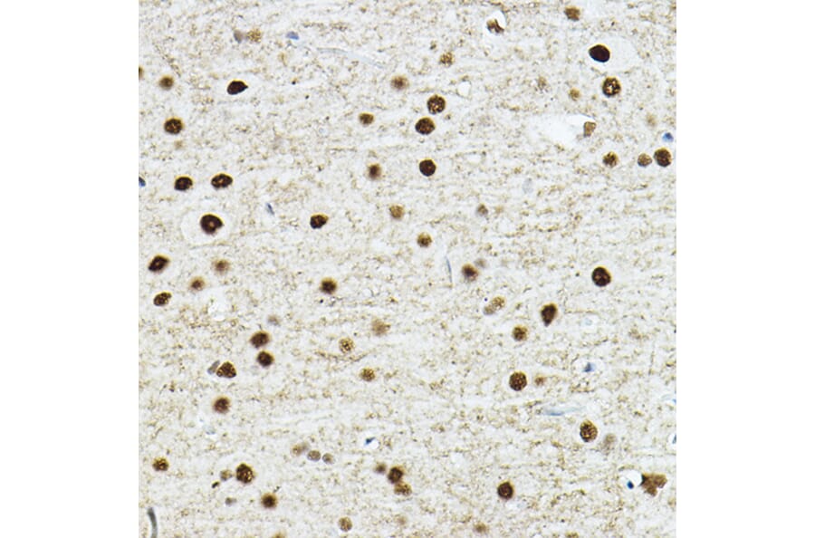 Immunohistochemistry - Anti-TEF1/TEAD-1 Antibody (A90118) - Antibodies.com