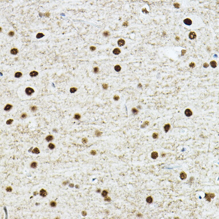 Immunohistochemistry - Anti-TEF1/TEAD-1 Antibody (A90118) - Antibodies.com