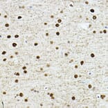 Immunohistochemistry - Anti-TEF1/TEAD-1 Antibody (A90118) - Antibodies.com