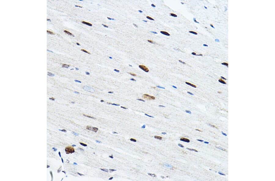 Immunohistochemistry - Anti-TEF1/TEAD-1 Antibody (A90118) - Antibodies.com