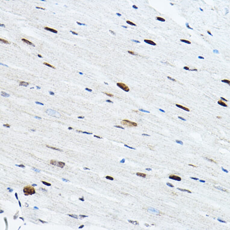 Immunohistochemistry - Anti-TEF1/TEAD-1 Antibody (A90118) - Antibodies.com