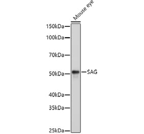 Western Blot - Anti-Retinal S antigen Antibody (A90119) - Antibodies.com