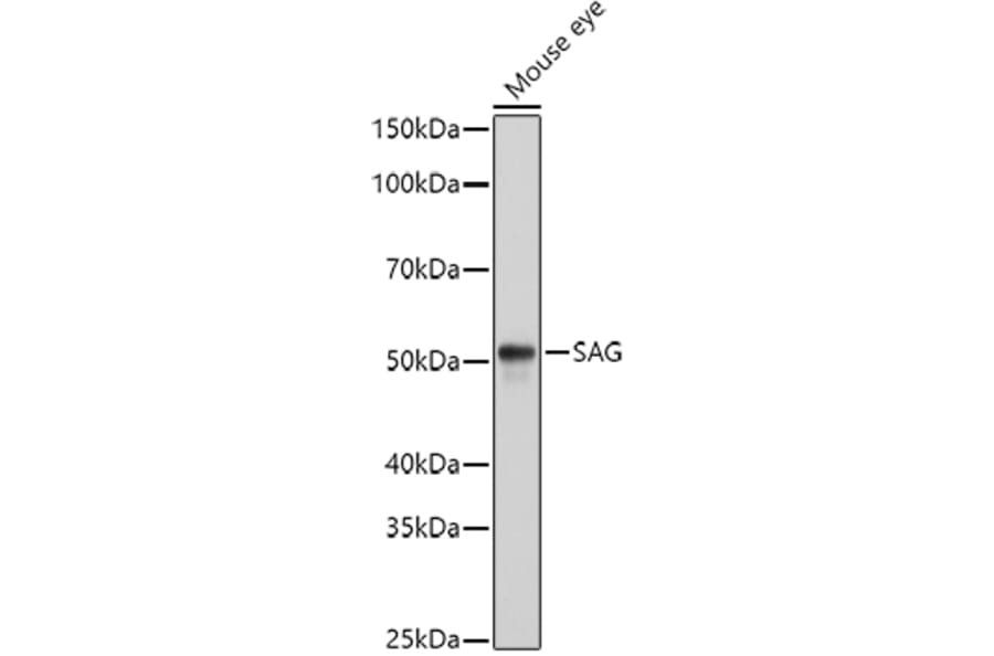 Western Blot - Anti-Retinal S antigen Antibody (A90119) - Antibodies.com