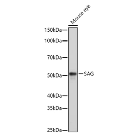 Western Blot - Anti-Retinal S antigen Antibody (A90119) - Antibodies.com
