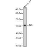 Western Blot - Anti-Retinal S antigen Antibody (A90119) - Antibodies.com