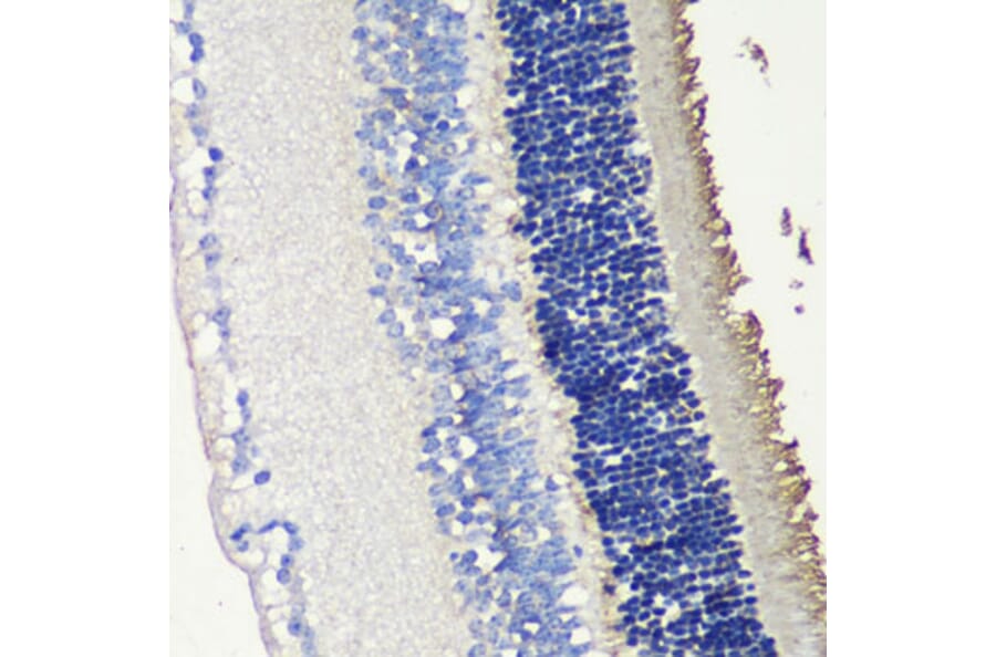 Immunohistochemistry - Anti-Retinal S antigen Antibody (A90119) - Antibodies.com