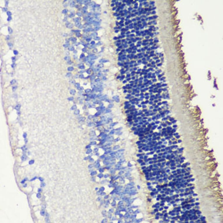 Immunohistochemistry - Anti-Retinal S antigen Antibody (A90119) - Antibodies.com