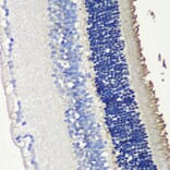 Immunohistochemistry - Anti-Retinal S antigen Antibody (A90119) - Antibodies.com