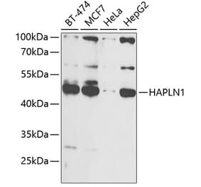 Western Blot - Anti-HAPLN1 Antibody (A90121) - Antibodies.com
